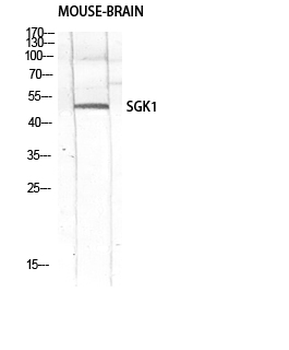 SGK1 Polyclonal Antibody