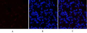 SGK1 Polyclonal Antibody