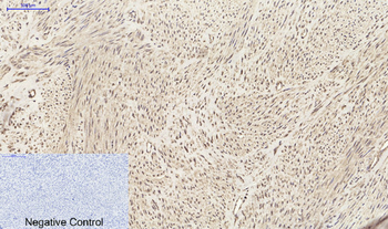 SDF-1 Polyclonal Antibody