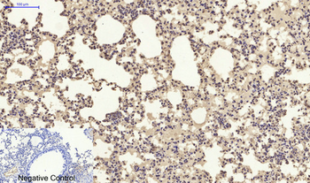 SDF-1 Polyclonal Antibody