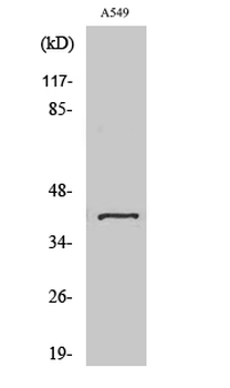 Sarcoglycan-β Polyclonal Antibody