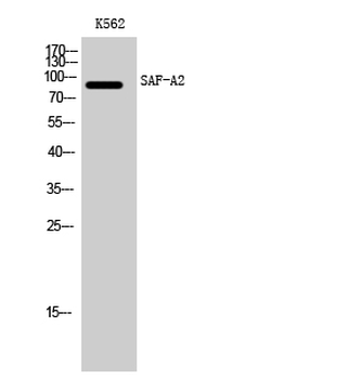 SAF-A2 Polyclonal Antibody