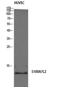 S-100A7L2 Polyclonal Antibody