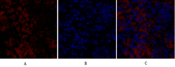 Rock-1 Polyclonal Antibody