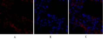 Rock-1 Polyclonal Antibody