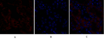 Rock-1 Polyclonal Antibody