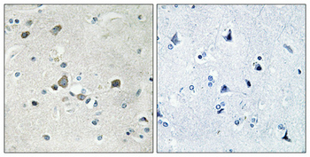 Ribosomal Protein S4Y1 Polyclonal Antibody