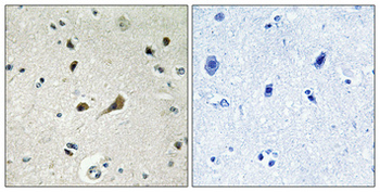 Ribosomal Protein L39 Polyclonal Antibody