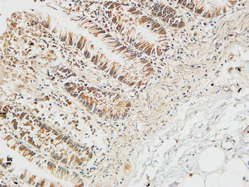 Reg IV Polyclonal Antibody