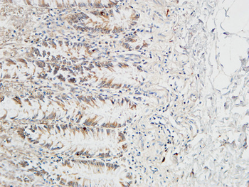 Reg IV Polyclonal Antibody