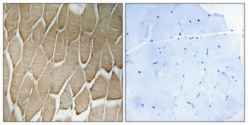 Rab 34 Polyclonal Antibody