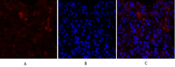 PPAR-γ Polyclonal Antibody