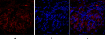 PPAR-γ Polyclonal Antibody