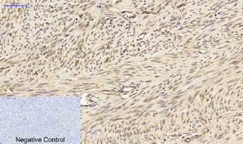 PPAR-γ Polyclonal Antibody