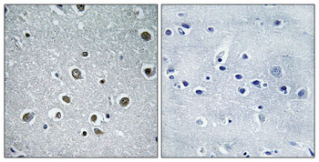 POLR3H Polyclonal Antibody