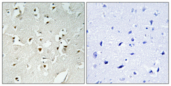 PMS1 Polyclonal Antibody