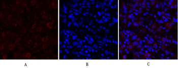 PKM2 Polyclonal Antibody