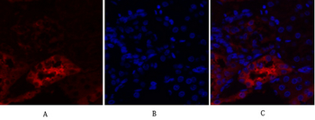 PKM2 Polyclonal Antibody