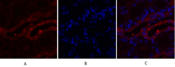 PKM2 Polyclonal Antibody