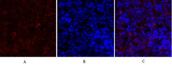 PKM2 Polyclonal Antibody