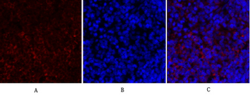 PKM2 Polyclonal Antibody