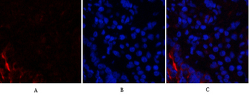 PI 3-kinase p85α/γ Polyclonal Antibody