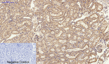 PI 3-kinase p85α/γ Polyclonal Antibody