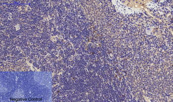 PI 3-kinase p85α/γ Polyclonal Antibody