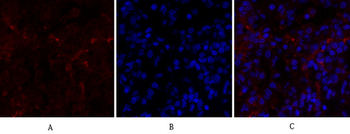PERK Polyclonal Antibody