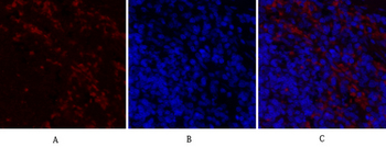 PERK Polyclonal Antibody