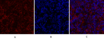 PERK Polyclonal Antibody