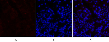PERK Polyclonal Antibody