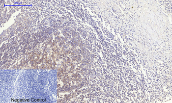 PERK Polyclonal Antibody