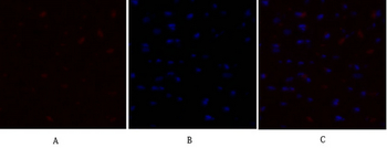 PDK1 Polyclonal Antibody
