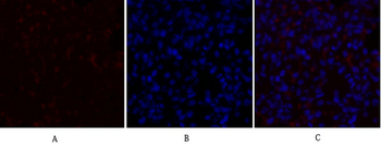 PDK1 Polyclonal Antibody