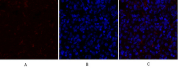 PDK1 Polyclonal Antibody