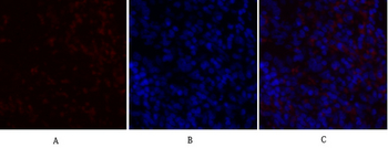 PDK1 Polyclonal Antibody