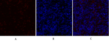 PDK1 Polyclonal Antibody