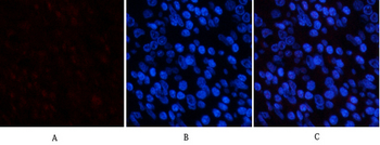 PDGF-B Polyclonal Antibody