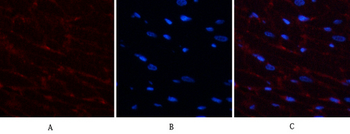 PDGF-B Polyclonal Antibody