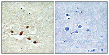 Pdcd-4 Polyclonal Antibody