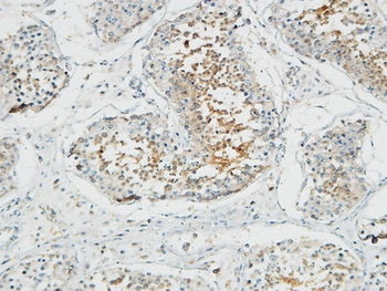 Patched Polyclonal Antibody