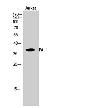 PAI-1 Polyclonal Antibody