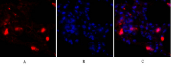 p38 Polyclonal Antibody