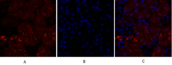 p38 Polyclonal Antibody