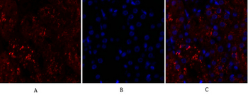 p38 Polyclonal Antibody