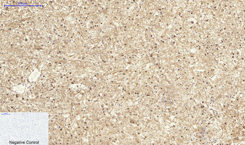 p27 Polyclonal Antibody