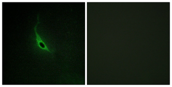 p164-RhoGEF Polyclonal Antibody