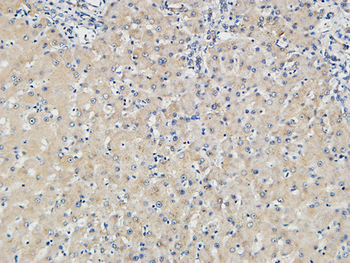 p15 Polyclonal Antibody