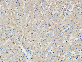 p15 Polyclonal Antibody